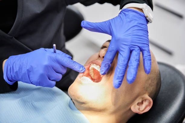 Best Emergency Treatment for Dental Infections or Abscesses in Oldsmar, FL